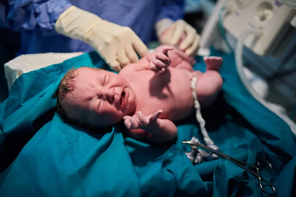 Doğum Türleri: Normal, Sezaryen ve Epidural Doğum Karşılaştırması
